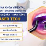 ViDental nghiên cứu công nghệ hàn trám răng Laser Tech