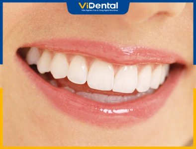 So sánh răng sứ sứ zirconia và cercon giúp bạn có lựa chọn phù hợp