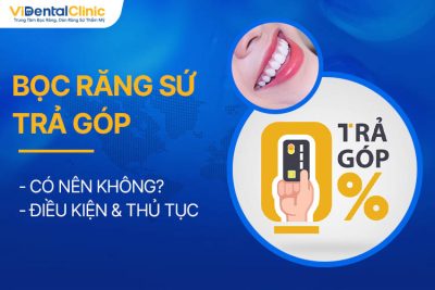 Bọc Răng Sứ Trả Góp Nên Hay Không? Điều Kiện & Thủ Tục