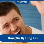 Răng sứ bị lung lay do đâu