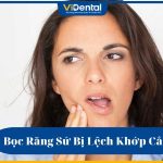 Bọc răng sứ bị lệch khớp cắn