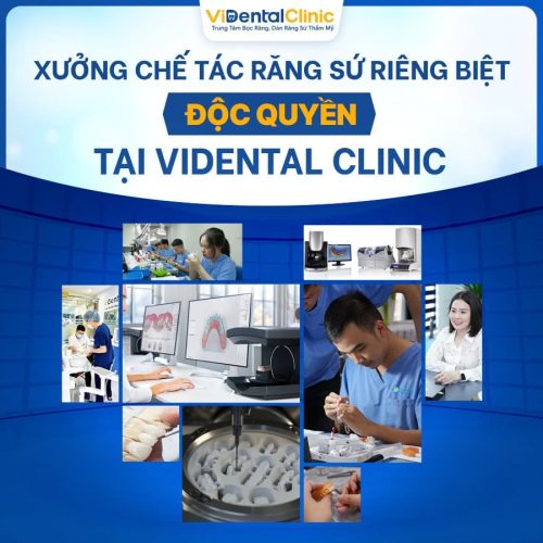 Xưởng chế tác đặc biệt tại ViDental Clinic 