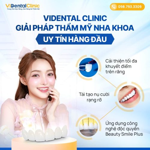 Bọc răng sứ tại Trung tâm ViDental Clinic