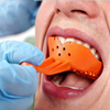 Lấy dấu răng và thiết kế mắc cài đúng tỷ lệ hàm răng