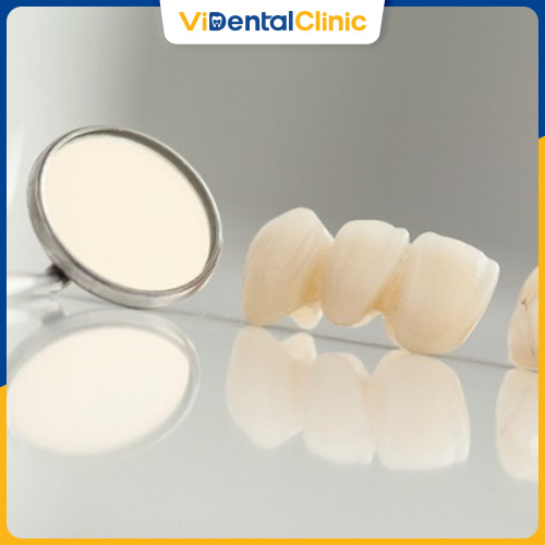 Răng sứ Centonia là dòng răng toàn sứ có chi phí rẻ 