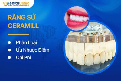 Răng Sứ Ceramill: Ưu - Nhược Điểm, Phân Loại Và Chi Phí