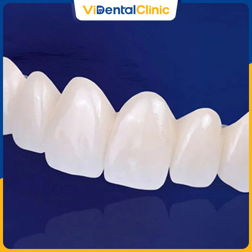 Răng sứ DDBIO là dòng răng sứ có thời gian sử dụng lâu dài hiện nay