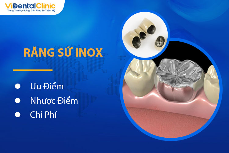 Răng Sứ Inox Có Tốt Không? Ưu Nhược Điểm Và Chi Phí