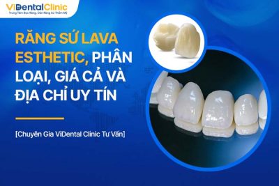 Răng Sứ Lava Esthetic: Phân Loại, Giá Cả Và Địa Chỉ Uy Tín