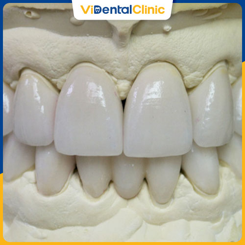 Răng sứ Zirconia có 2 loại phổ biến