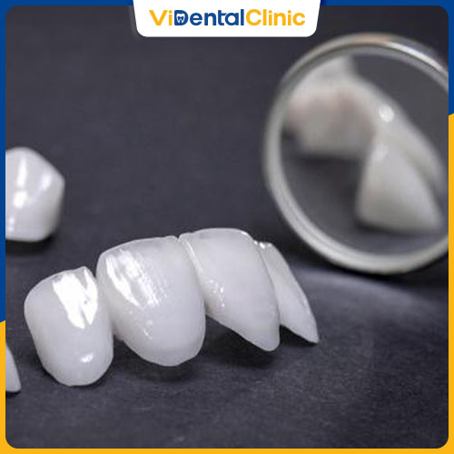 Răng sứ Zirconia có tính thẩm mỹ cao, được nhiều khách hàng lựa chọn