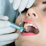 Các nha khoa có giá trám răng không giống nhau