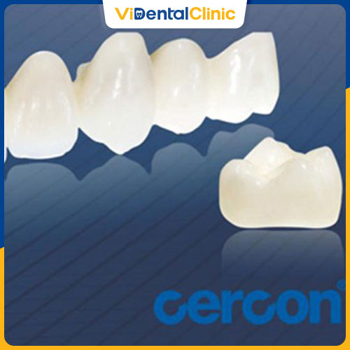 Răng sứ Cercon được đánh giá là một trong những loại răng sứ tốt nhất hiện nay