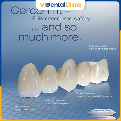 Răng sứ Cercon HT có 16 tone màu lựa chọn