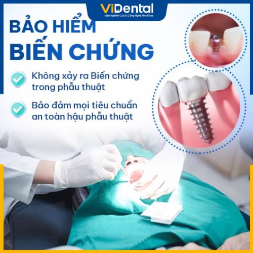 Trồng răng Implant tại nha khoa uy tín