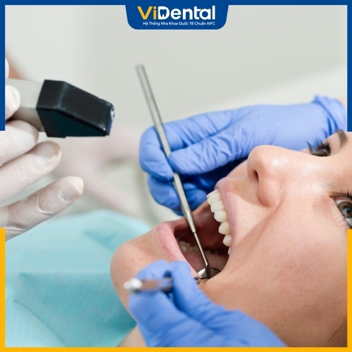 Răng sứ xuống màu do sai sót kỹ thuật