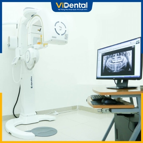 Máy chụp X-quang răng Conebeam CT 3D tại ViDental Clinic