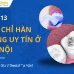 Địa Chỉ Hàn Răng Uy Tín Ở Hà Nội