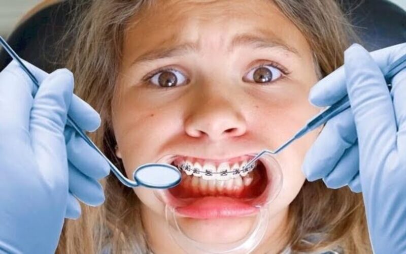 Mục đích của việc niềng răng là giúp cho bệnh nhân có thể khắc phục được tình trạng răng miệng