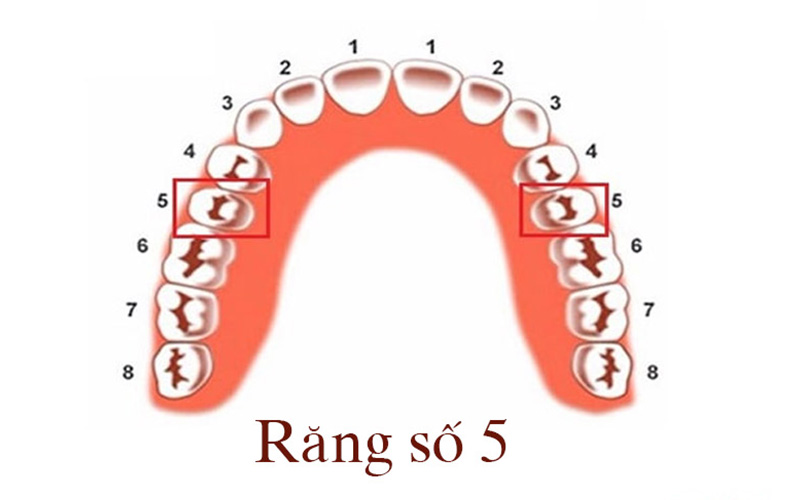 Răng số 5 có chức năng cực kỳ quan trọng trên cung hàm và gần như không thể thay thế