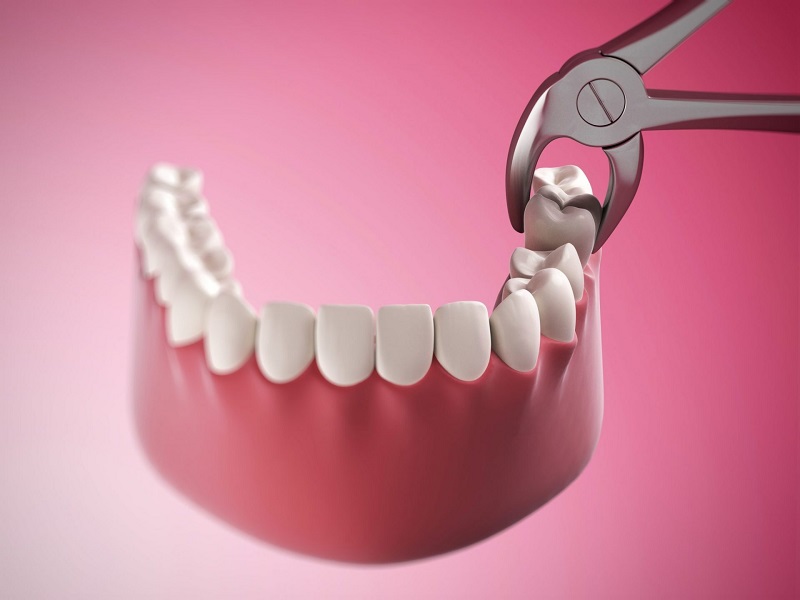 Răng số 8 trong khoang miệng của con người