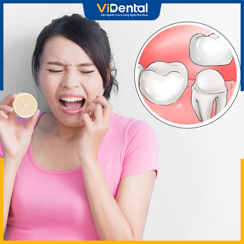 Răng bọc sứ bị đau nhức do đâu?