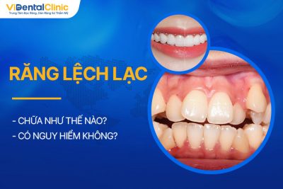 Răng Lệch Lạc Chữa Như Thế Nào? Có Nguy Hiểm Không?