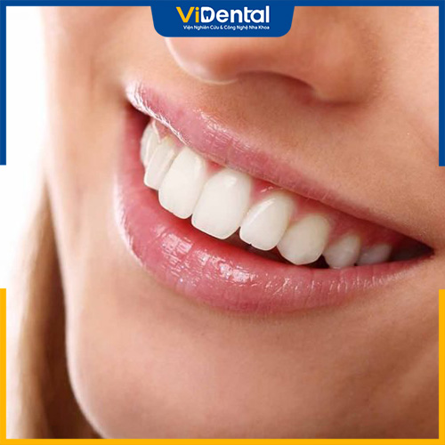 ViDental Clinic là địa chỉ mang đến cho bạn hàm răng sứ bền, đẹp