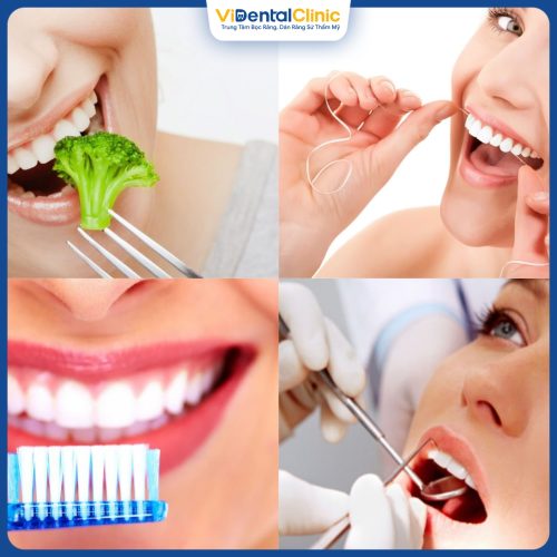 Chế độ chăm sóc răng miệng, ăn uống ảnh hưởng tới độ bền miếng trám