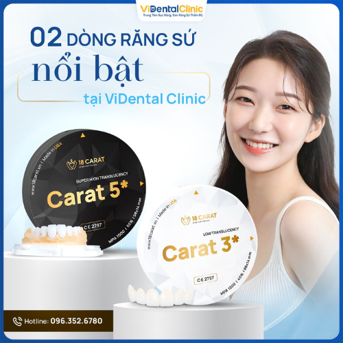 Dòng sứ được yêu thích tại ViDental Clinic