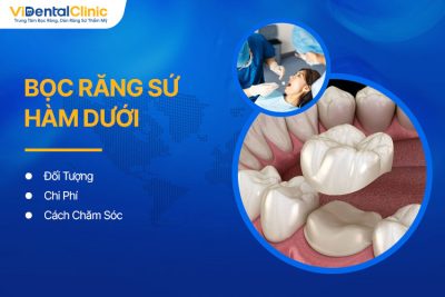 Trường Hợp Nên Bọc Răng Sứ Hàm Dưới? Chi Phí Bao Nhiêu?