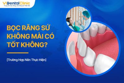 Bọc Răng Sứ Không Mài Có Tốt Không? Trường Hợp Nên Thực Hiện