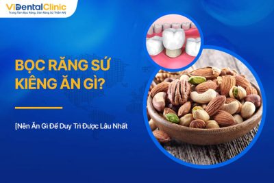 Bọc Răng Sứ Kiêng Ăn Gì? Nên Ăn Gì Để Duy Trì Được Lâu Nhất