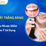 Gel Tẩy Trắng Răng Là Gì? Ưu Nhược Điểm, Lưu Ý Sử Dụng