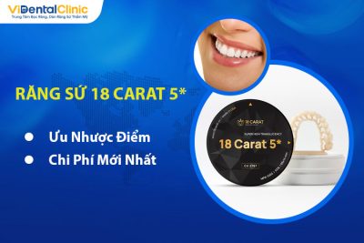 Răng Sứ 18 Carat 5*: Ưu Nhược Điểm Và Giá Mới Nhất