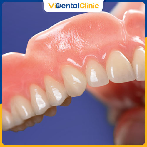 Răng sứ Vita có màu sắc trắng sáng tự nhiên, độ trong và bóng giống hệt răng thật.