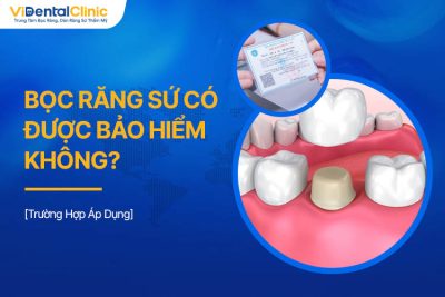 Bọc Răng Sứ Có Được Bảo Hiểm Không? Trường Hợp Áp Dụng