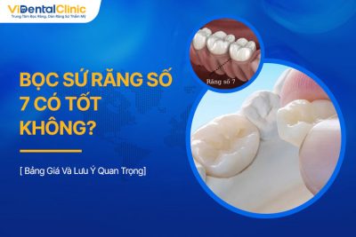 Bọc Sứ Răng Số 7 Có Tốt Không? Bảng Giá Và Lưu Ý Quan Trọng