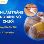 3 Cách Làm Trắng Răng Bằng Vỏ Chuối Và Lưu Ý Cần Nhớ