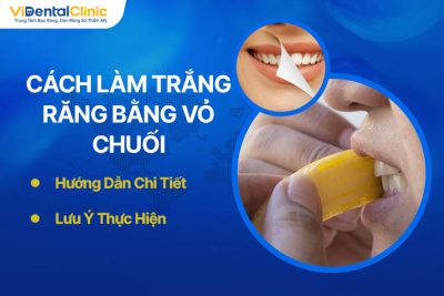 3 Cách Làm Trắng Răng Bằng Vỏ Chuối Và Lưu Ý Cần Nhớ