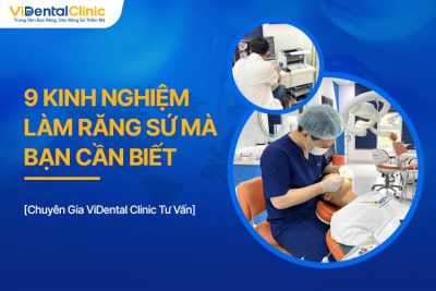 9 Kinh Nghiệm Làm Răng Sứ Mà Bạn Cần Biết Để Đạt Kết Quả Tốt