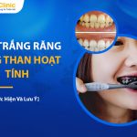 4 Cách Làm Trắng Răng Bằng Than Hoạt Tính Và Lưu Ý Cần Nhớ