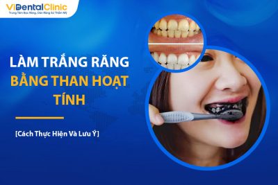 4 Cách Làm Trắng Răng Bằng Than Hoạt Tính Và Lưu Ý Cần Nhớ