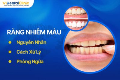 Răng Nhiễm Màu: Nguyên Nhân, Cách Xử Lý Và Phòng Ngừa 