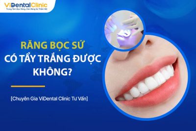 Răng Sứ Có Tẩy Trắng Được Không? Chuyên Gia Giải Đáp