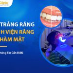 Có Nên Tẩy Trắng Răng Bệnh Viện Răng Hàm Mặt Không?