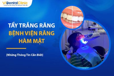 Có Nên Tẩy Trắng Răng Bệnh Viện Răng Hàm Mặt Không?