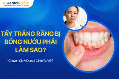 Tẩy Trắng Răng Bị Bỏng Nướu Phải Làm Sao? Giải Đáp Chi Tiết