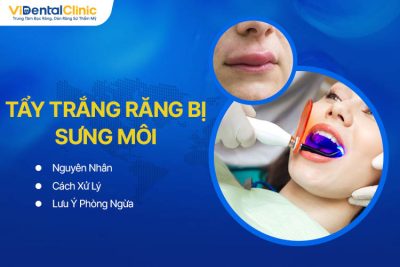 Tẩy Trắng Răng Bị Sưng Môi: Nguyên Nhân Và Cách Xử Lý