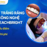 Tẩy Trắng Răng Công Nghệ Bleachbright: Ưu Điểm, Chi Phí